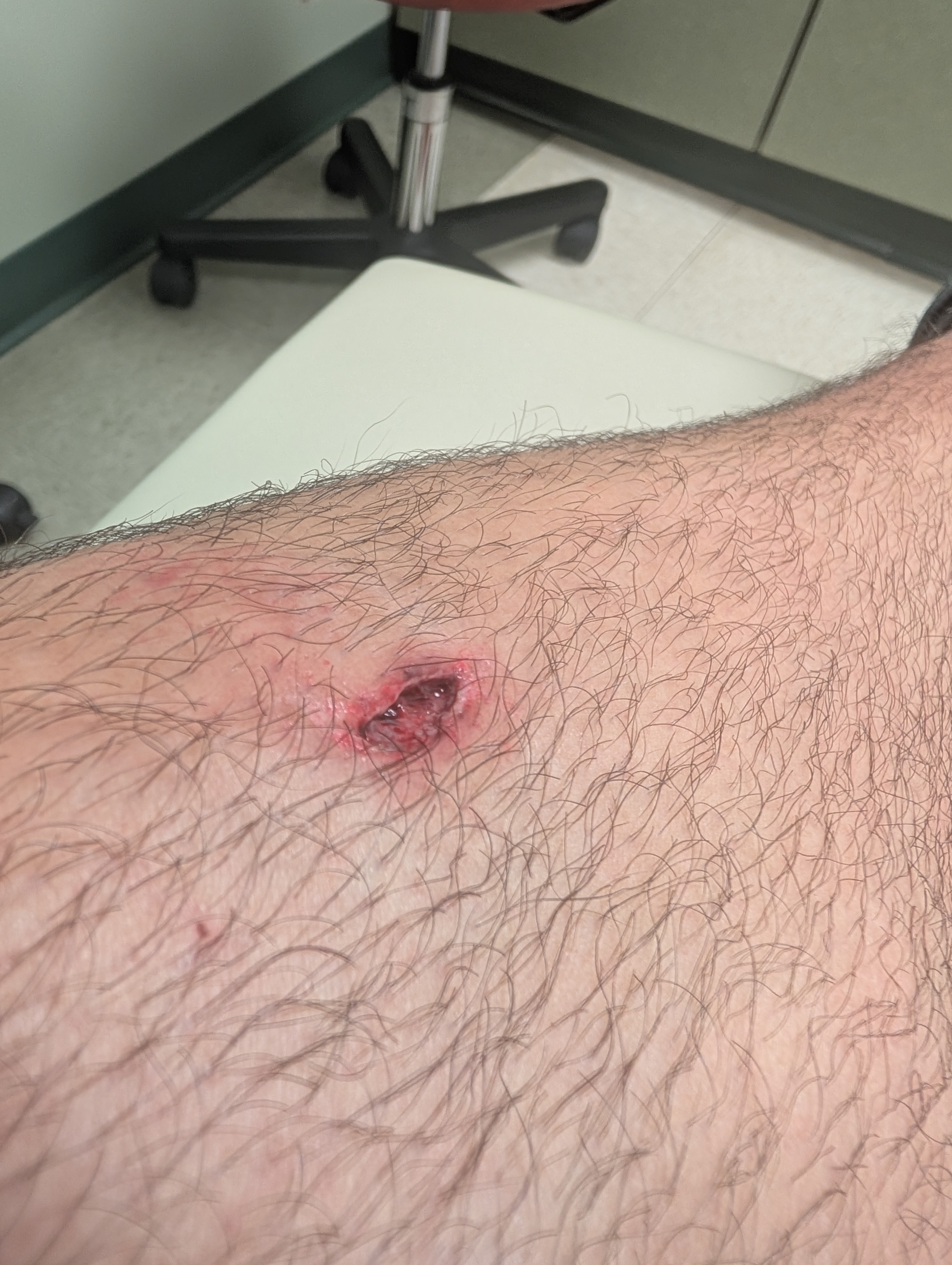 A deep, wide cut in my shin